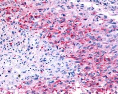 Immunohistochemistry-Paraffin: GPR32 Antibody - BSA Free [NLS1680]