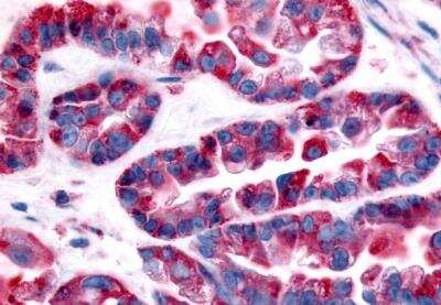 Immunohistochemistry-Paraffin: GPR32 Antibody - BSA Free [NLS1680]