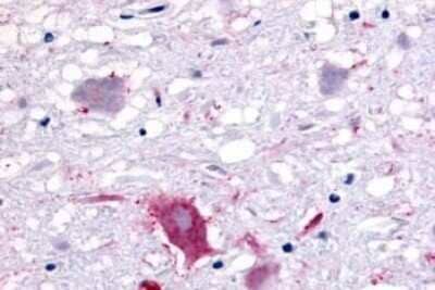 Immunohistochemistry-Paraffin: GPR32 Antibody - BSA Free [NLS1680]