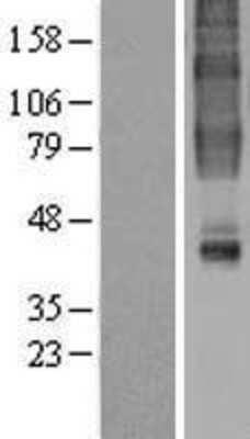 Western Blot: GPR32 Overexpression Lysate [NBL1-11274]