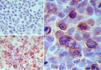 Immunohistochemistry-Paraffin: GPR35 Antibody [NBP2-24640]