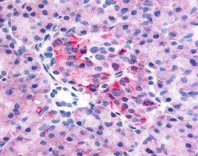 Immunohistochemistry-Paraffin: GPR35 Antibody - BSA Free [NLS3]