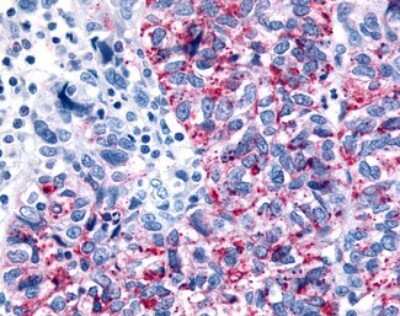 Immunohistochemistry-Paraffin: GPR35 Antibody - BSA Free [NLS3]