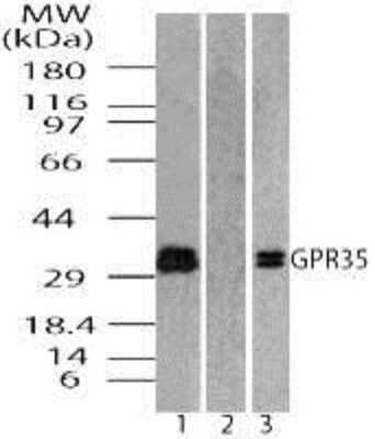 Western Blot: GPR35 Antibody [NBP2-24640]