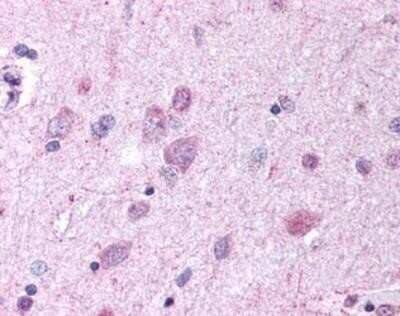 Immunohistochemistry-Paraffin: GPR37 Antibody - BSA Free [NBP1-02361]