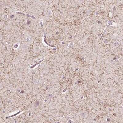 Immunohistochemistry: GPR37 Antibody [NBP2-49540]