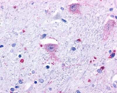 Immunohistochemistry-Paraffin: GPR37 Antibody - BSA Free [NLS131]