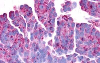 Immunohistochemistry-Paraffin: GPR37 Antibody - BSA Free [NLS131]