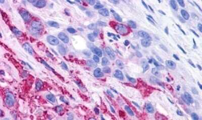 Immunohistochemistry-Paraffin: GPR37 Antibody - BSA Free [NLS131]