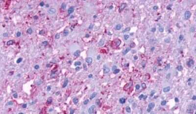 Immunohistochemistry-Paraffin: GPR37 Antibody - BSA Free [NLS131]