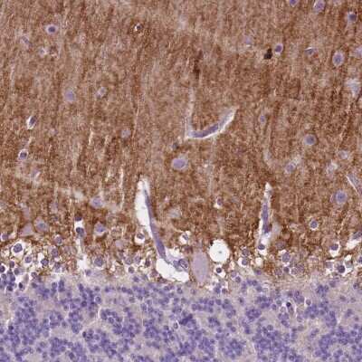 Immunohistochemistry: GPR37L1 Antibody [NBP2-49419]