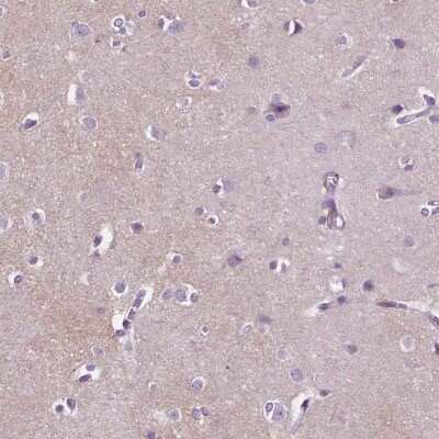 Immunohistochemistry-Paraffin: GPR37L1 Antibody [NBP2-49419]