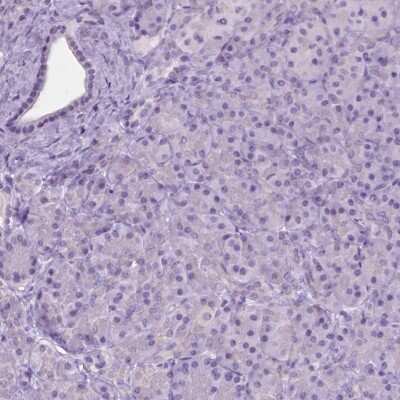 Immunohistochemistry-Paraffin: GPR37L1 Antibody [NBP2-49419]