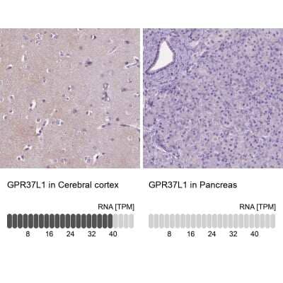 Immunohistochemistry-Paraffin: GPR37L1 Antibody [NBP2-49419]
