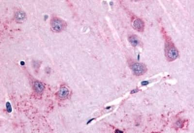 Immunohistochemistry-Paraffin: GPR39 Antibody [NBP3-14359]