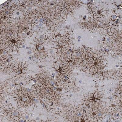 Immunohistochemistry: GPR39 Antibody [NBP1-87551]