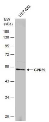 Western Blot: GPR39 Antibody [NBP3-13032]