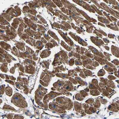 Immunohistochemistry-Paraffin: GPR4 Antibody [NBP1-87463]