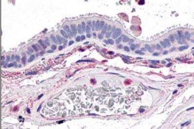 Immunohistochemistry-Paraffin: GPR4 Antibody - BSA Free [NLS143]
