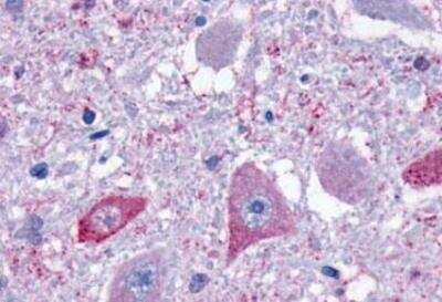 Immunohistochemistry-Paraffin: GPR4 Antibody - BSA Free [NLS143]