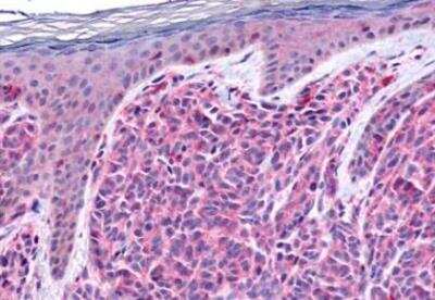 Immunohistochemistry-Paraffin: GPR4 Antibody - BSA Free [NLS143]