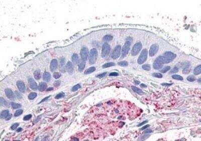 Immunohistochemistry-Paraffin: GPR4 Antibody - BSA Free [NLS144]