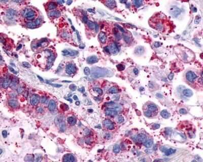 Immunohistochemistry-Paraffin: GPR4 Antibody - BSA Free [NLS144]