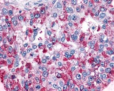 Immunohistochemistry-Paraffin: GPR4 Antibody - BSA Free [NLS145]