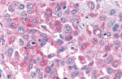 Immunohistochemistry-Paraffin: GPR4 Antibody - BSA Free [NLS145]