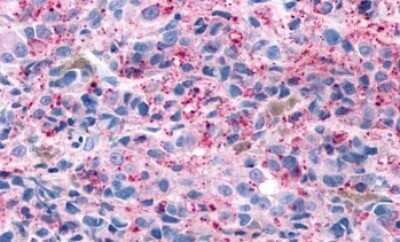 Immunohistochemistry-Paraffin: GPR4 Antibody - BSA Free [NLS145]