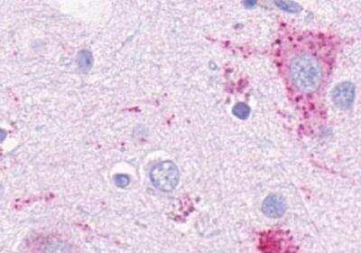Immunohistochemistry-Paraffin: GPR4 Antibody - BSA Free [NLS145]