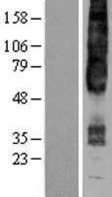 Western Blot: GPR4 Overexpression Lysate [NBP2-04284]