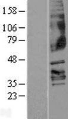 Western Blot: FFAR3/GPR41 Overexpression Lysate [NBP2-04289]