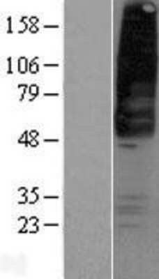 Western Blot: GPR42 Overexpression Lysate [NBP2-10472]