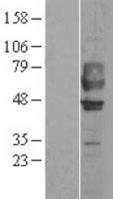 Western Blot: CRTH-2/GPR44 Overexpression Lysate [NBL1-11281]