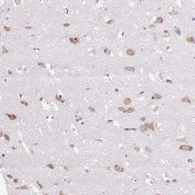 Immunohistochemistry-Paraffin: GPR45 Antibody [NBP2-49204]