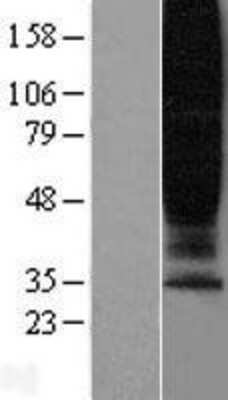 Western Blot: GPR45 Overexpression Lysate [NBL1-11282]