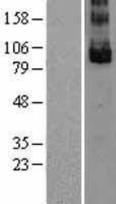 Western Blot: Lgr5/GPR49 Overexpression Lysate [NBL1-12509]