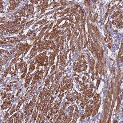 Immunohistochemistry-Paraffin: GPR50 Antibody [NBP2-14069]