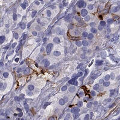 Immunohistochemistry-Paraffin: GPR50 Antibody [NBP2-14069]