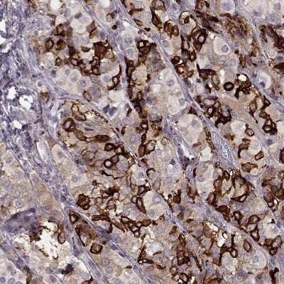Immunohistochemistry-Paraffin: GPR50 Antibody [NBP2-56258]