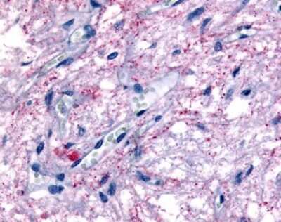 Immunohistochemistry-Paraffin: GPR50 Antibody - BSA Free [NLS6618]