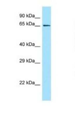 Western Blot: GPR50 Antibody [NBP1-98295]