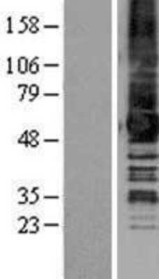 Western Blot: GPR50 Overexpression Lysate [NBP2-04269]