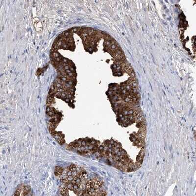 Immunohistochemistry-Paraffin: GPR52 Antibody [NBP2-33913]