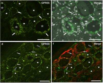 Immunohistochemistry: GPR55 Antibody - BSA Free [NB110-55498]