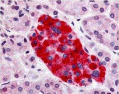 Immunohistochemistry-Paraffin: GPR55 Antibody - BSA Free [NB110-55498]