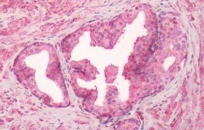 Immunohistochemistry-Paraffin: GPR55 Antibody - BSA Free [NLS6817]