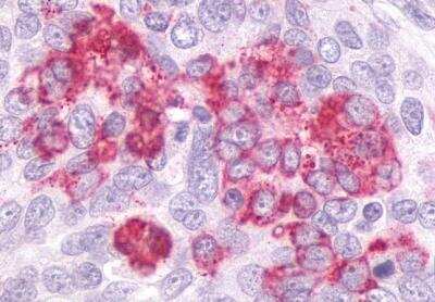 Immunohistochemistry-Paraffin: GPR55 Antibody - BSA Free [NLS6817]