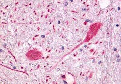 Immunohistochemistry-Paraffin: GPR55 Antibody - BSA Free [NLS6817]